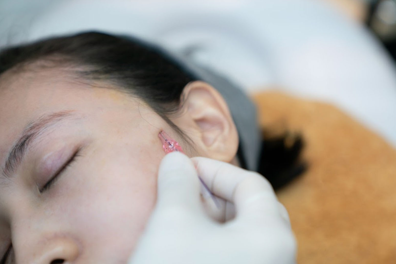 ร้อยไหม ที่ไหนดี